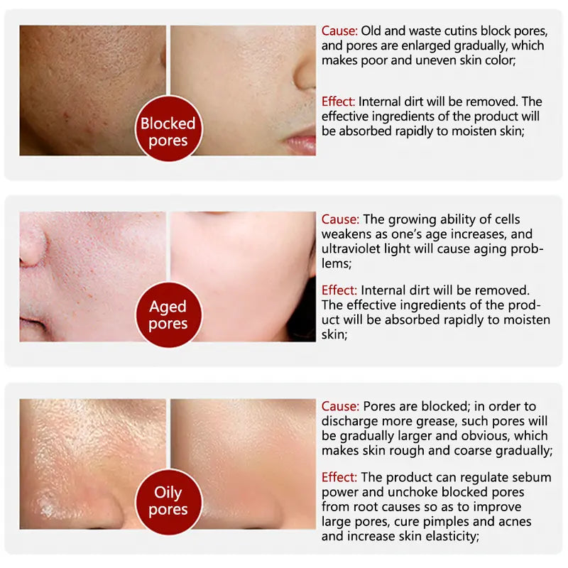 LANBENA Pore Skin Care Serum Facial Essence for Shrinking Pores Dry Skin Sensitive Skin Alcohol Free Flower Moisturize Smooth Delicate Firming Skin Repair Comfort Moisturizer Moisture Hydrate