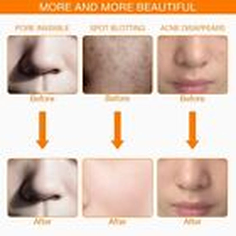 7 Colors LED Light Photon Face Neck Mask Rejuvenation Skin Wrinkles Therapy Mask